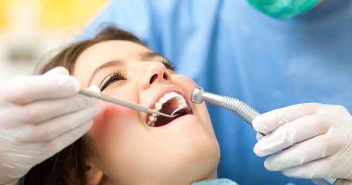 Ilustrasi pembersihan karang gigi (Freepik)