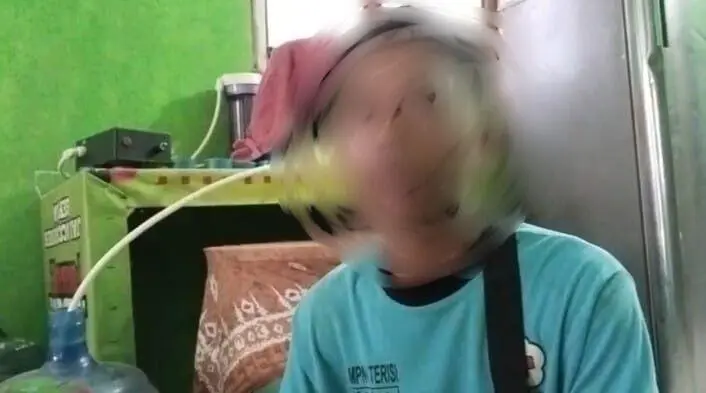 Nenek Renta di Indramayu Jadi Korban Penganiayaan Saudara Kandung